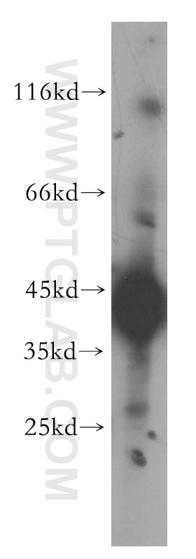 Western Blot (WB) analysis of HepG2 cells using HLA class I (HLA-B) Polyclonal antibody (17260-1-AP)