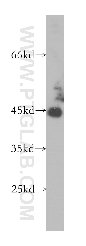 Western Blot (WB) analysis of Jurkat cells using HLA class I (HLA-B) Polyclonal antibody (17260-1-AP)