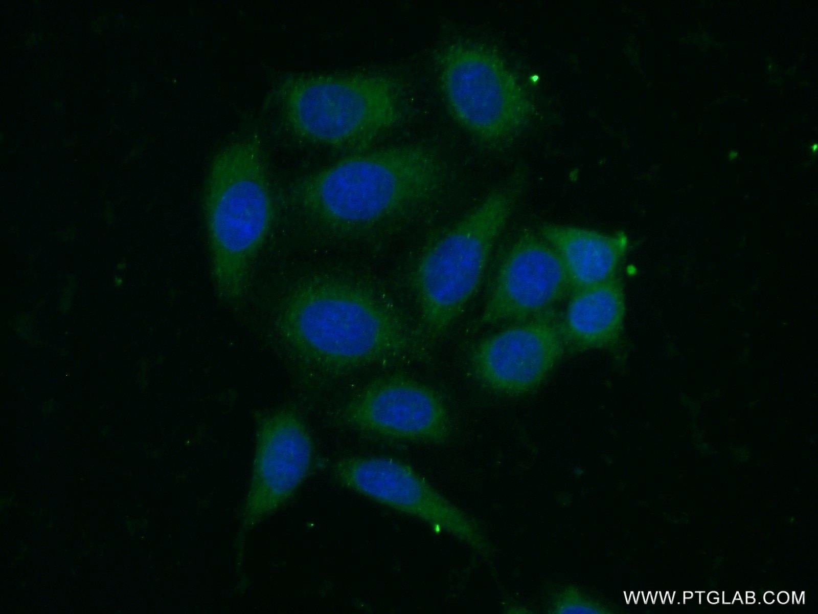 Immunofluorescence (IF) / fluorescent staining of HeLa cells using HLA class I (HLA-C) Polyclonal antibody (15777-1-AP)