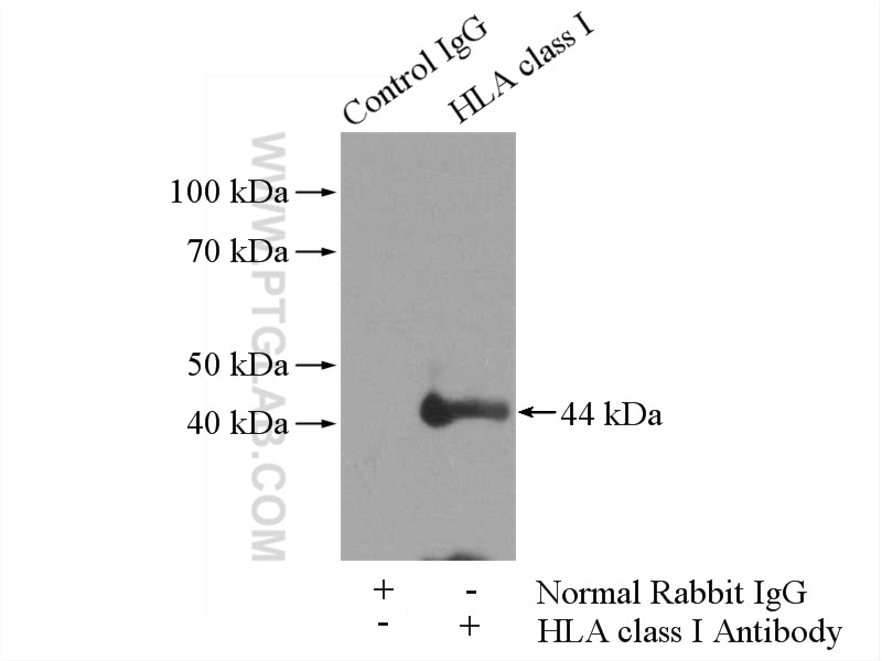 Immunoprecipitation (IP) experiment of Jurkat cells using HLA class I (HLA-C) Polyclonal antibody (15777-1-AP)