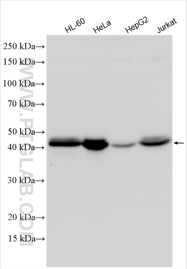Western Blot (WB) analysis of various lysates using HLA class I (HLA-C) Polyclonal antibody (15777-1-AP)