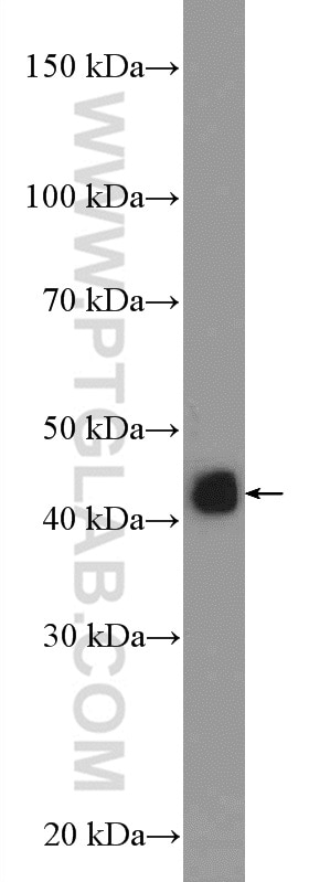 HLA class I (HLA-C) Polyclonal antibody