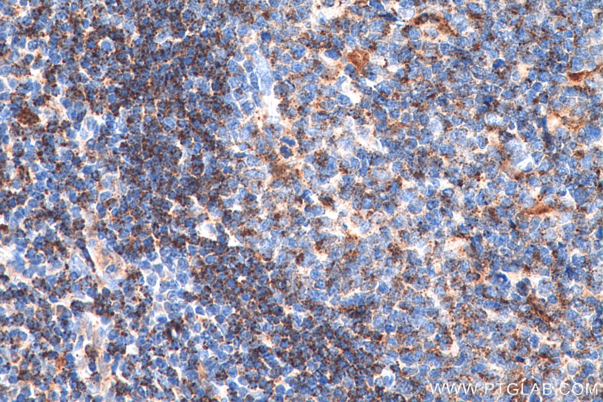 Immunohistochemistry (IHC) staining of human tonsillitis tissue using HLA-DMA Polyclonal antibody (11838-1-AP)