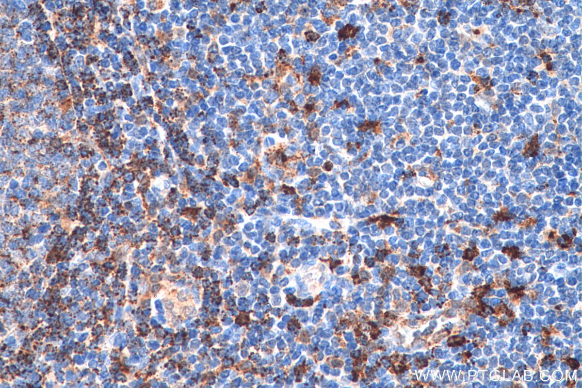 Immunohistochemistry (IHC) staining of human tonsillitis tissue using HLA-DMA Polyclonal antibody (11838-1-AP)