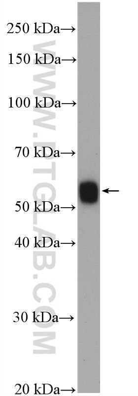 Western Blot (WB) analysis of rat spleen tissue using HLA-DMA Polyclonal antibody (11838-1-AP)