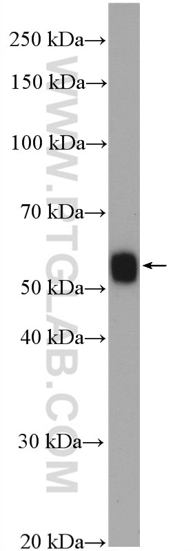 WB analysis of rat spleen using 11838-1-AP