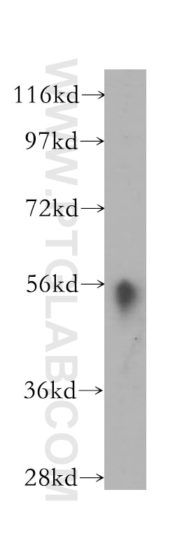 Western Blot (WB) analysis of human liver tissue using HLA-DMA Polyclonal antibody (11838-1-AP)