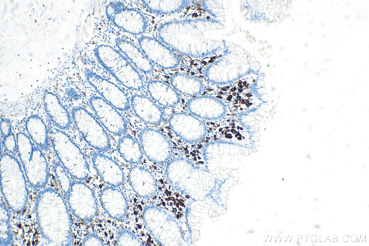 Immunohistochemistry (IHC) staining of human colon tissue using HLA-DMA Recombinant antibody (82899-2-RR)
