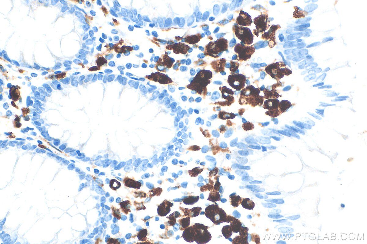 IHC staining of human colon using 82899-2-RR