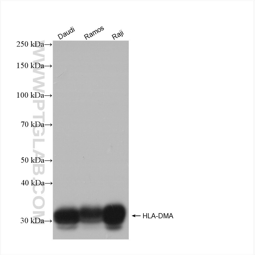 Western Blot (WB) analysis of various lysates using HLA-DMA Recombinant antibody (82899-2-RR)