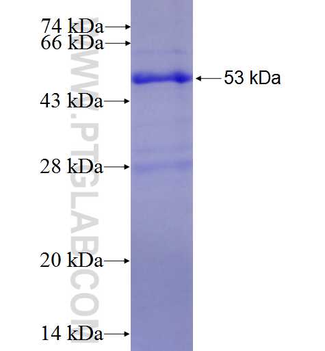 HLA-DMA fusion protein Ag2452 SDS-PAGE