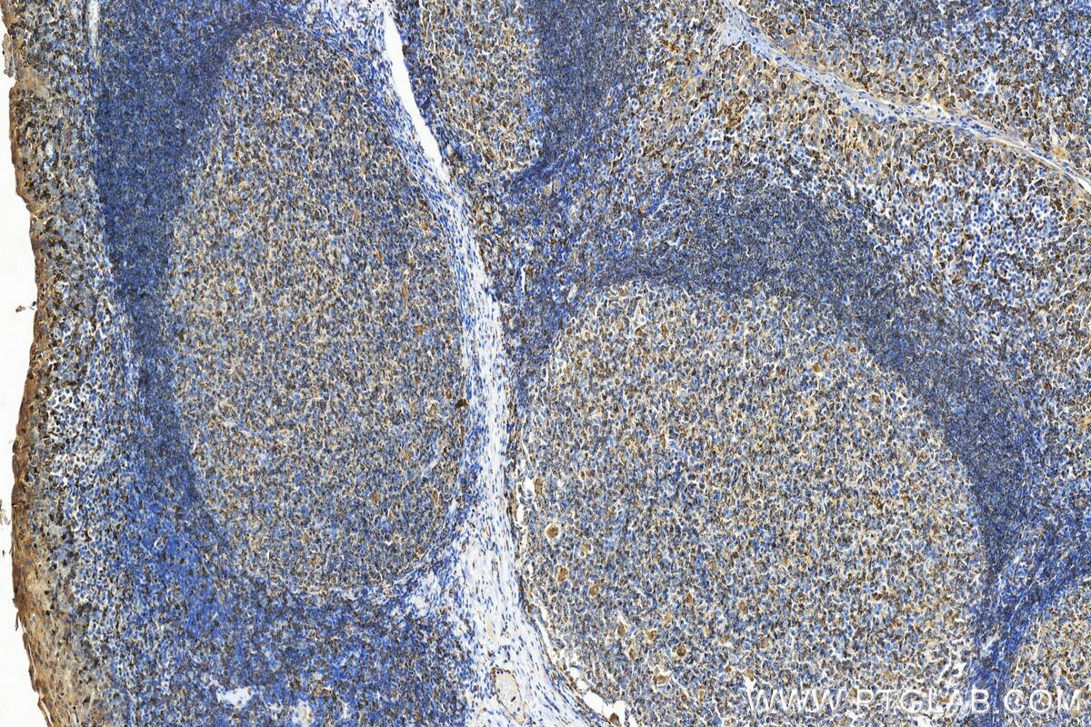 Immunohistochemistry (IHC) staining of human tonsillitis tissue using HLA-DMB Polyclonal antibody (21704-1-AP)