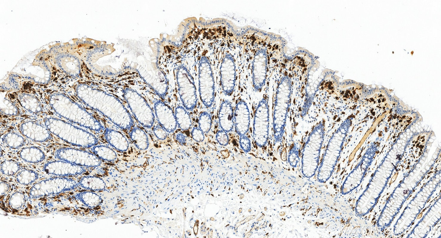 Immunohistochemistry (IHC) staining of human colon tissue using HLA-DMB Recombinant monoclonal antibody (82922-1-RR)