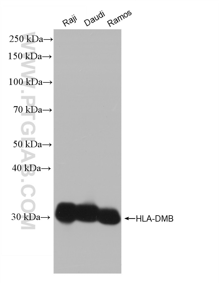 Western Blot (WB) analysis of various lysates using HLA-DMB Recombinant antibody (82922-1-RR)