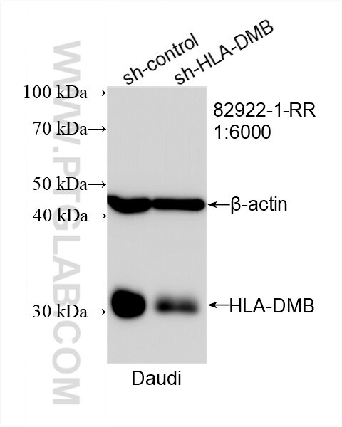Western Blot (WB) analysis of Daudi cells using HLA-DMB Recombinant antibody (82922-1-RR)