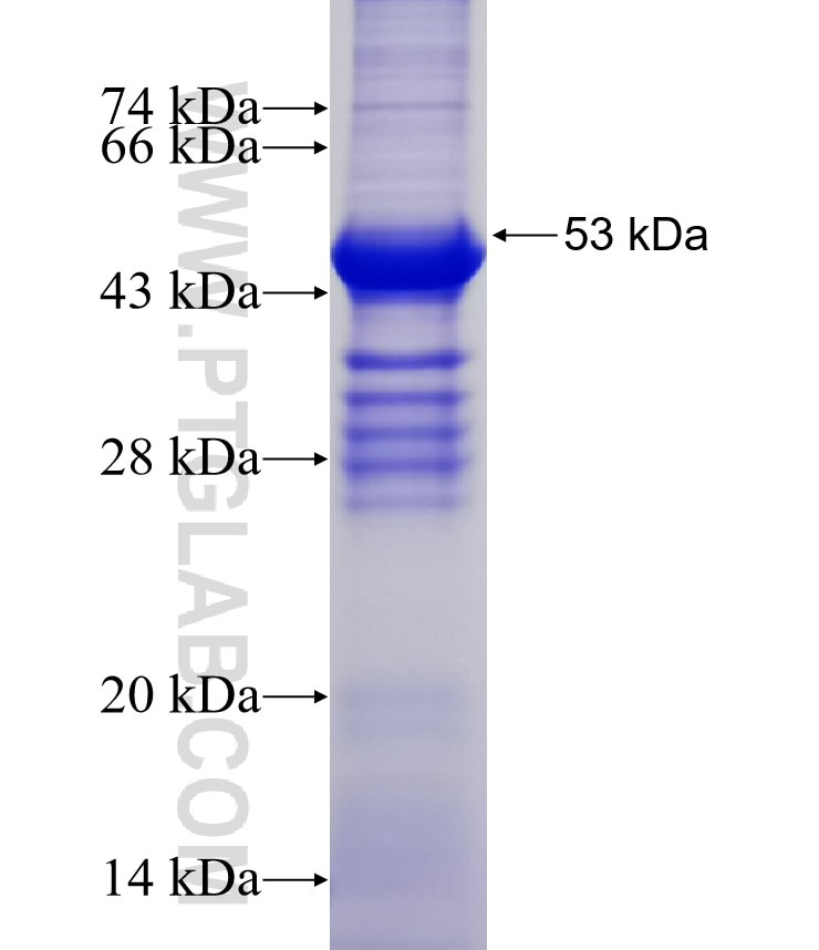 HLA-DMB fusion protein Ag16320 SDS-PAGE