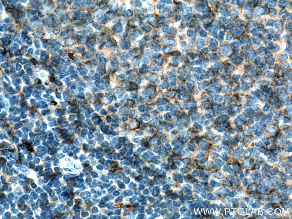 Immunohistochemistry (IHC) staining of human tonsillitis tissue using HLA-DPA1 Polyclonal antibody (16109-1-AP)