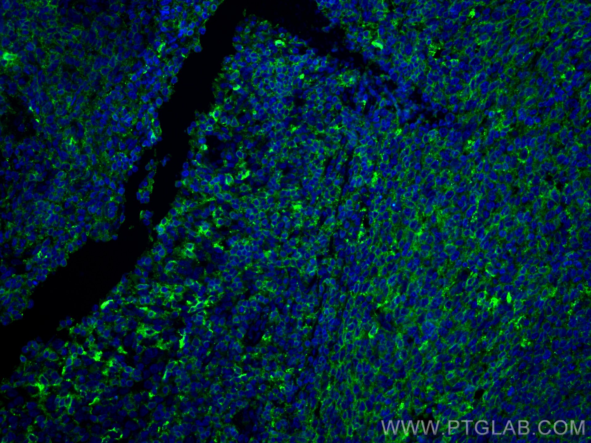 Immunofluorescence (IF) / fluorescent staining of human tonsillitis tissue using HLA-DPB1 Polyclonal antibody (11298-1-AP)