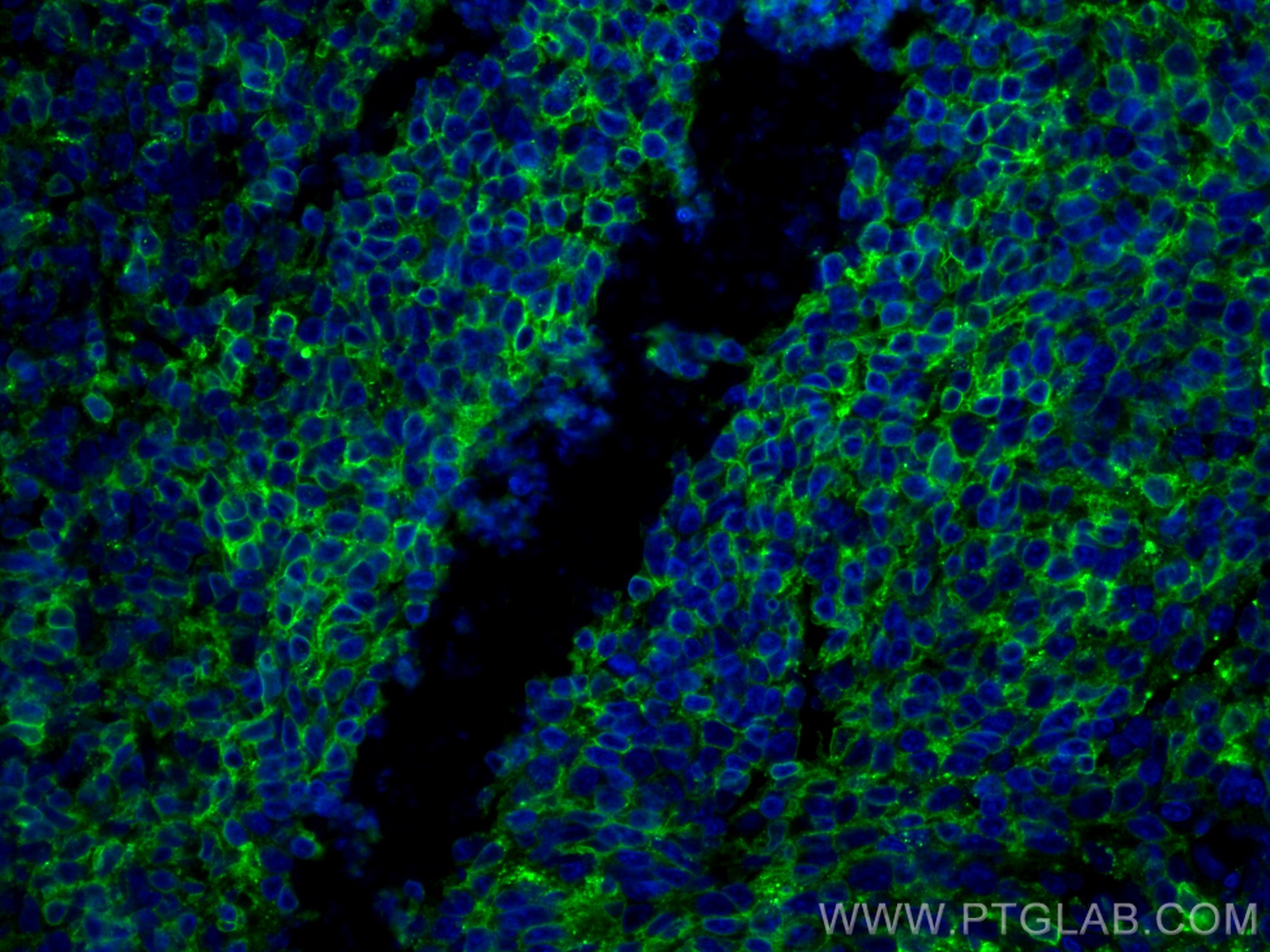 Immunofluorescence (IF) / fluorescent staining of human tonsillitis tissue using HLA-DPB1 Polyclonal antibody (11298-1-AP)