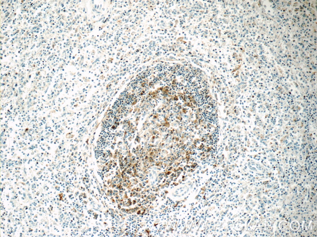Immunohistochemistry (IHC) staining of human spleen tissue using HLA-DPB1 Polyclonal antibody (11298-1-AP)