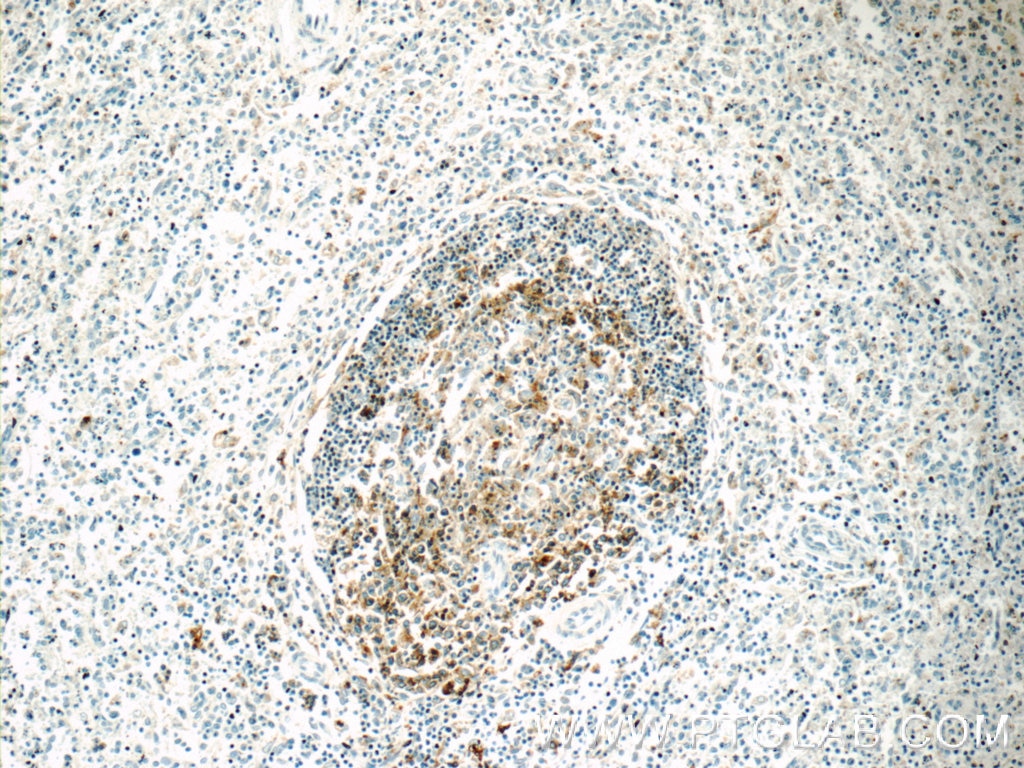 IHC staining of human spleen using 11298-1-AP