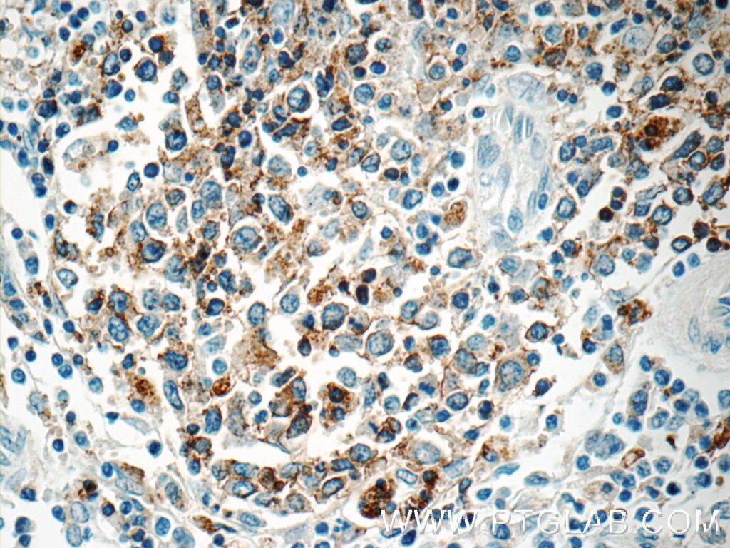 Immunohistochemistry (IHC) staining of human spleen tissue using HLA-DPB1 Polyclonal antibody (11298-1-AP)