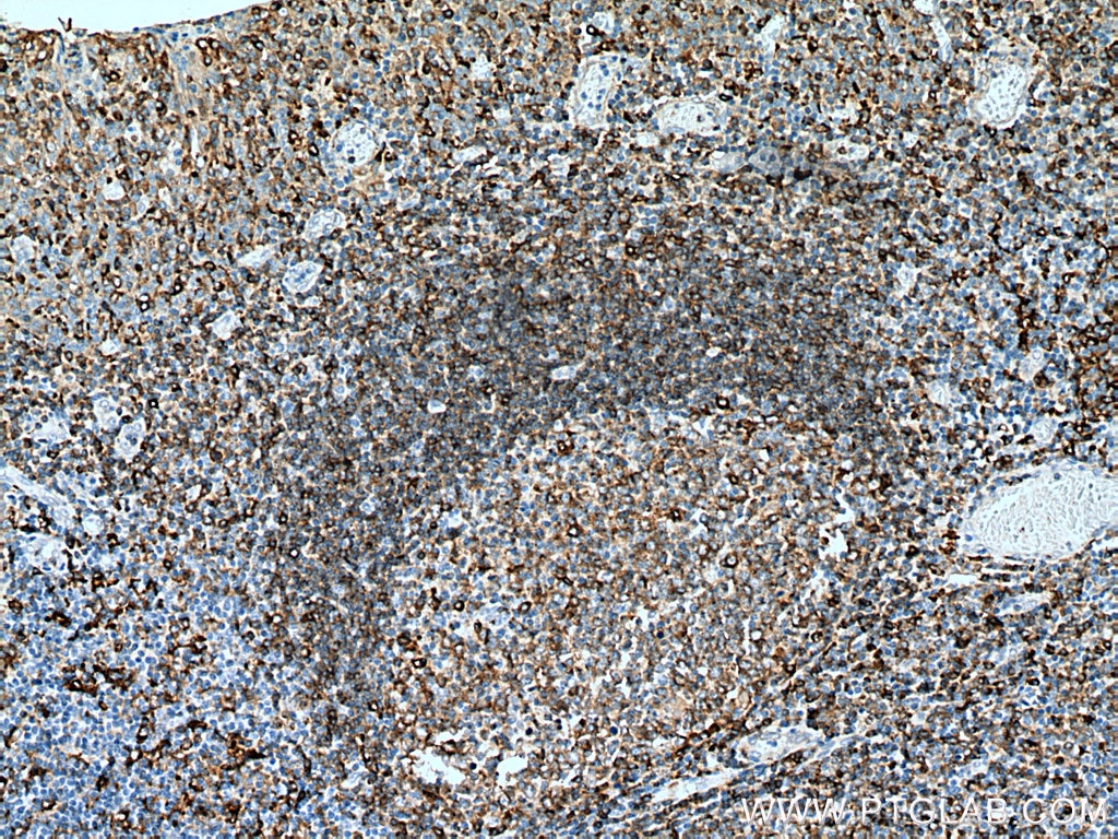 Immunohistochemistry (IHC) staining of human tonsillitis tissue using HLA-DPB1 Polyclonal antibody (11298-1-AP)