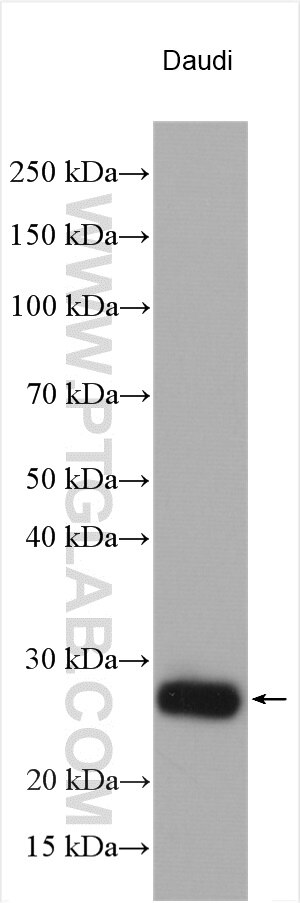 WB analysis using 11298-1-AP