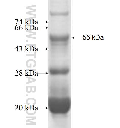 HLA-DPB1 fusion protein Ag1815 SDS-PAGE