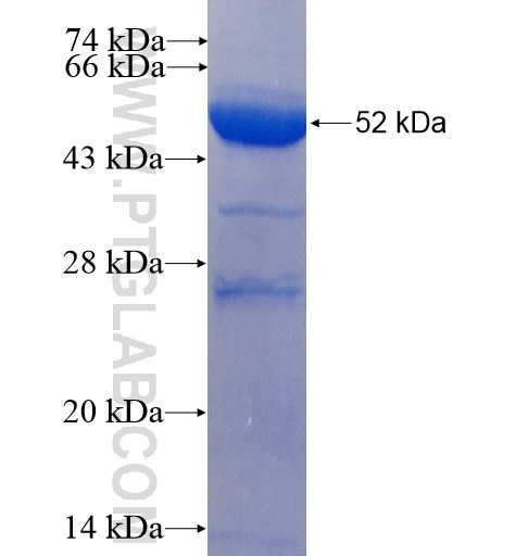 HLA-DQA1 fusion protein Ag10224 SDS-PAGE