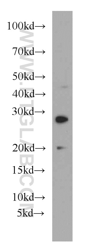 Western Blot (WB) analysis of mouse spleen tissue using HLA-DQA2 Polyclonal antibody (55072-1-AP)