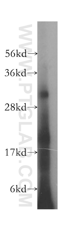 Western Blot (WB) analysis of K-562 cells using HLA-DQB2 Polyclonal antibody (17315-1-AP)