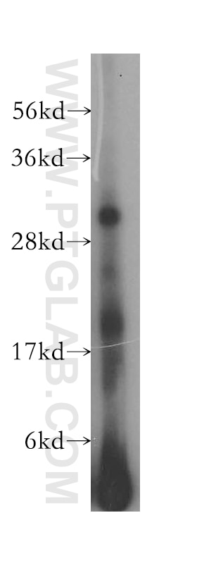 Western Blot (WB) analysis of Raji cells using HLA-DQB2 Polyclonal antibody (17315-1-AP)