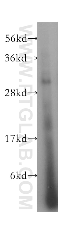 Western Blot (WB) analysis of HepG2 cells using HLA-DQB2 Polyclonal antibody (17315-1-AP)