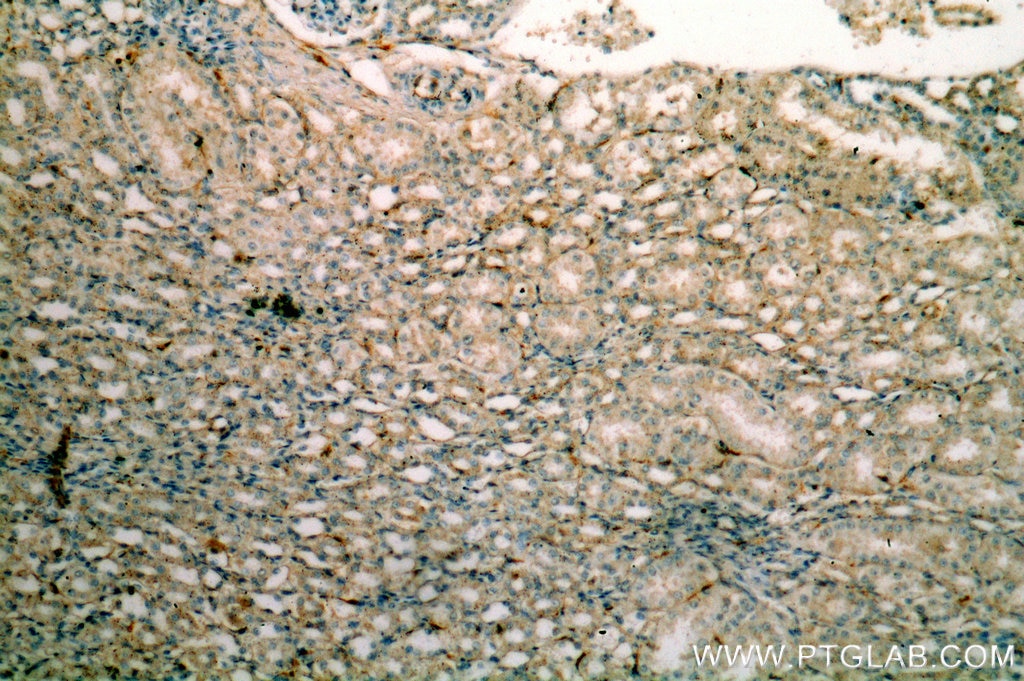 Immunohistochemistry (IHC) staining of human kidney tissue using HLA-DRA Polyclonal antibody (17221-1-AP)