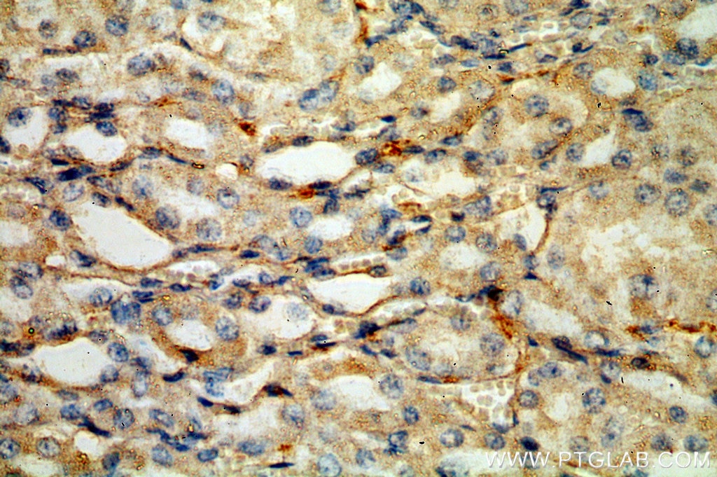 Immunohistochemistry (IHC) staining of human kidney tissue using HLA-DRA Polyclonal antibody (17221-1-AP)