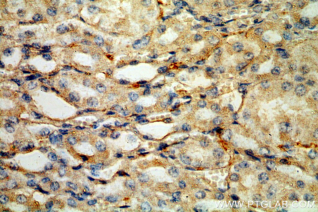 Immunohistochemistry (IHC) staining of human kidney tissue using HLA-DRA Polyclonal antibody (17221-1-AP)