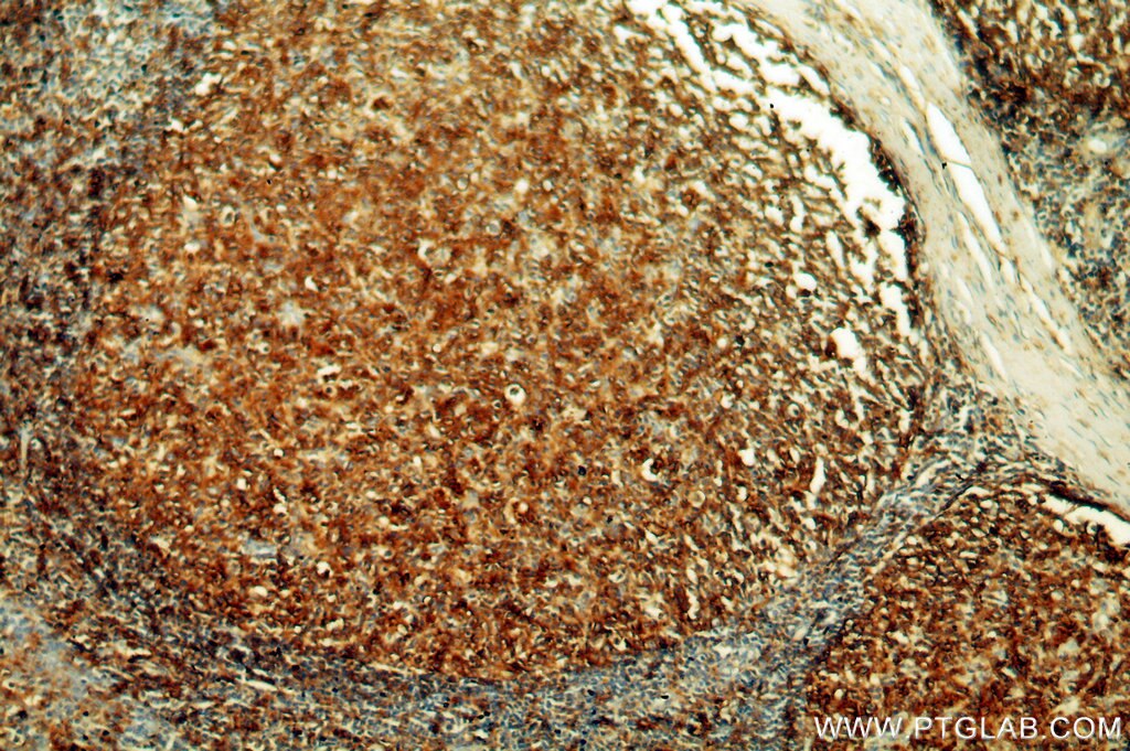 Immunohistochemistry (IHC) staining of human tonsil tissue using HLA-DRA Polyclonal antibody (17221-1-AP)