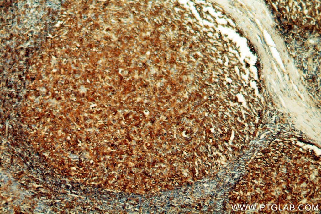 IHC staining of human tonsil using 17221-1-AP