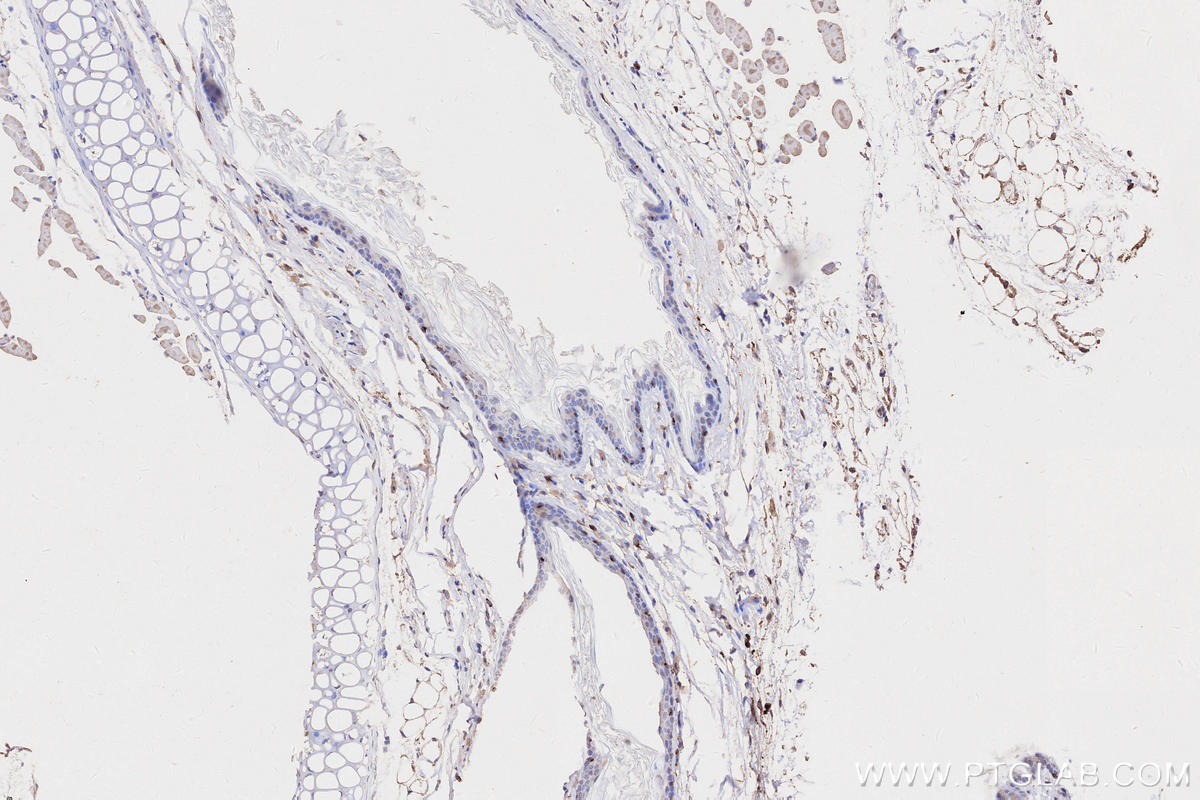 Immunohistochemistry (IHC) staining of mouse skin tissue using HLA-DRA Monoclonal antibody (68543-1-Ig)