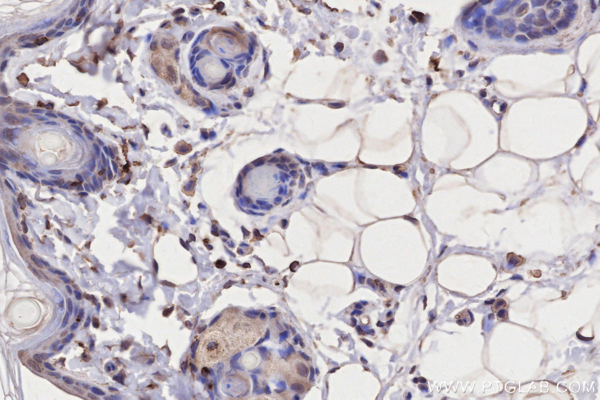 Immunohistochemistry (IHC) staining of rat skin tissue using HLA-DRA Monoclonal antibody (68543-1-Ig)