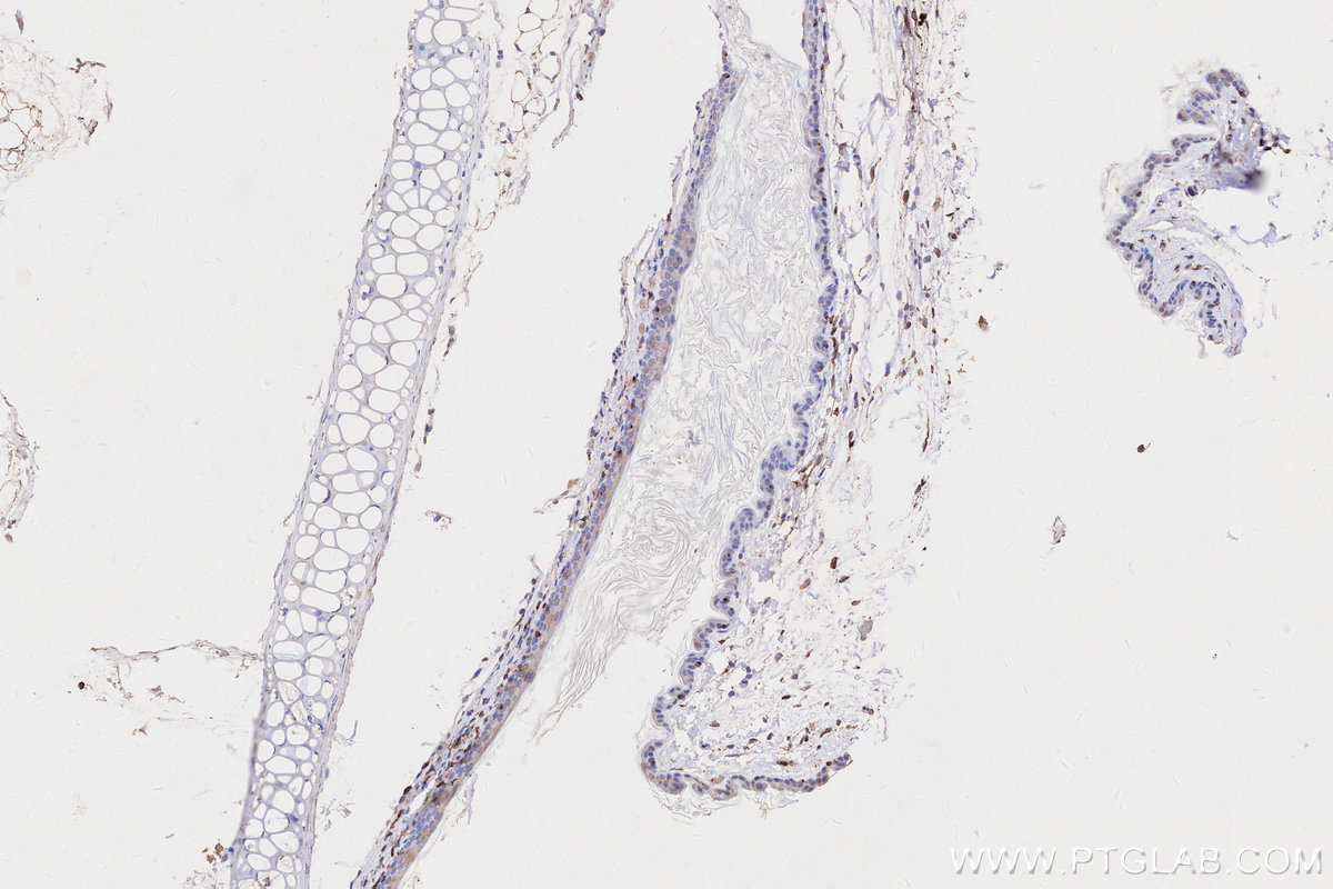 Immunohistochemistry (IHC) staining of mouse skin tissue using HLA-DRA Monoclonal antibody (68543-1-Ig)