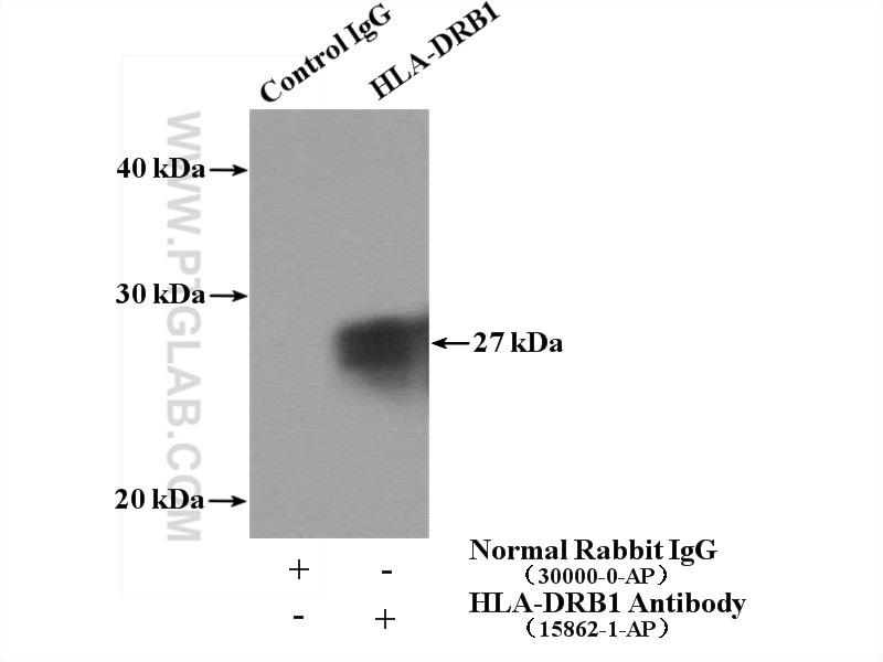 Immunoprecipitation (IP) experiment of Raji cells using HLA-DRB1 Polyclonal antibody (15862-1-AP)