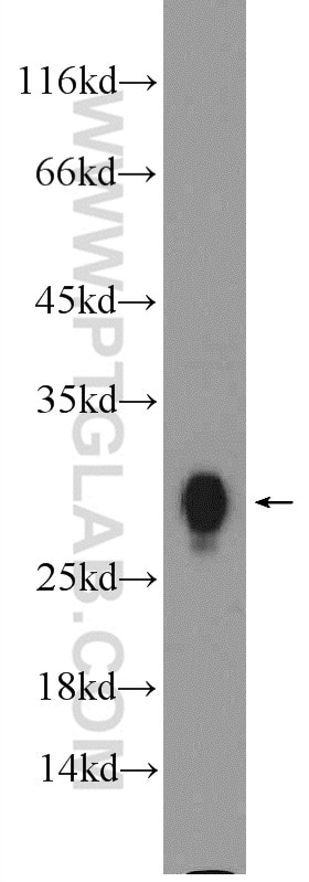 Western Blot (WB) analysis of human spleen tissue using HLA-DRB1 Polyclonal antibody (15862-1-AP)