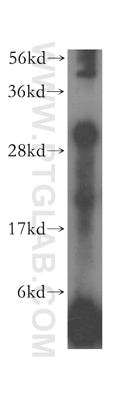 Western Blot (WB) analysis of Raji cells using HLA-DRB1 Polyclonal antibody (15862-1-AP)