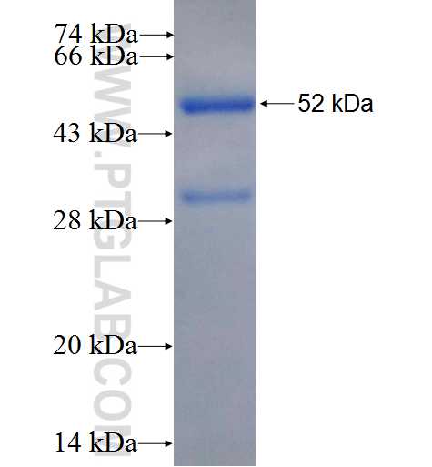 HLA-DRB1 fusion protein Ag8405 SDS-PAGE