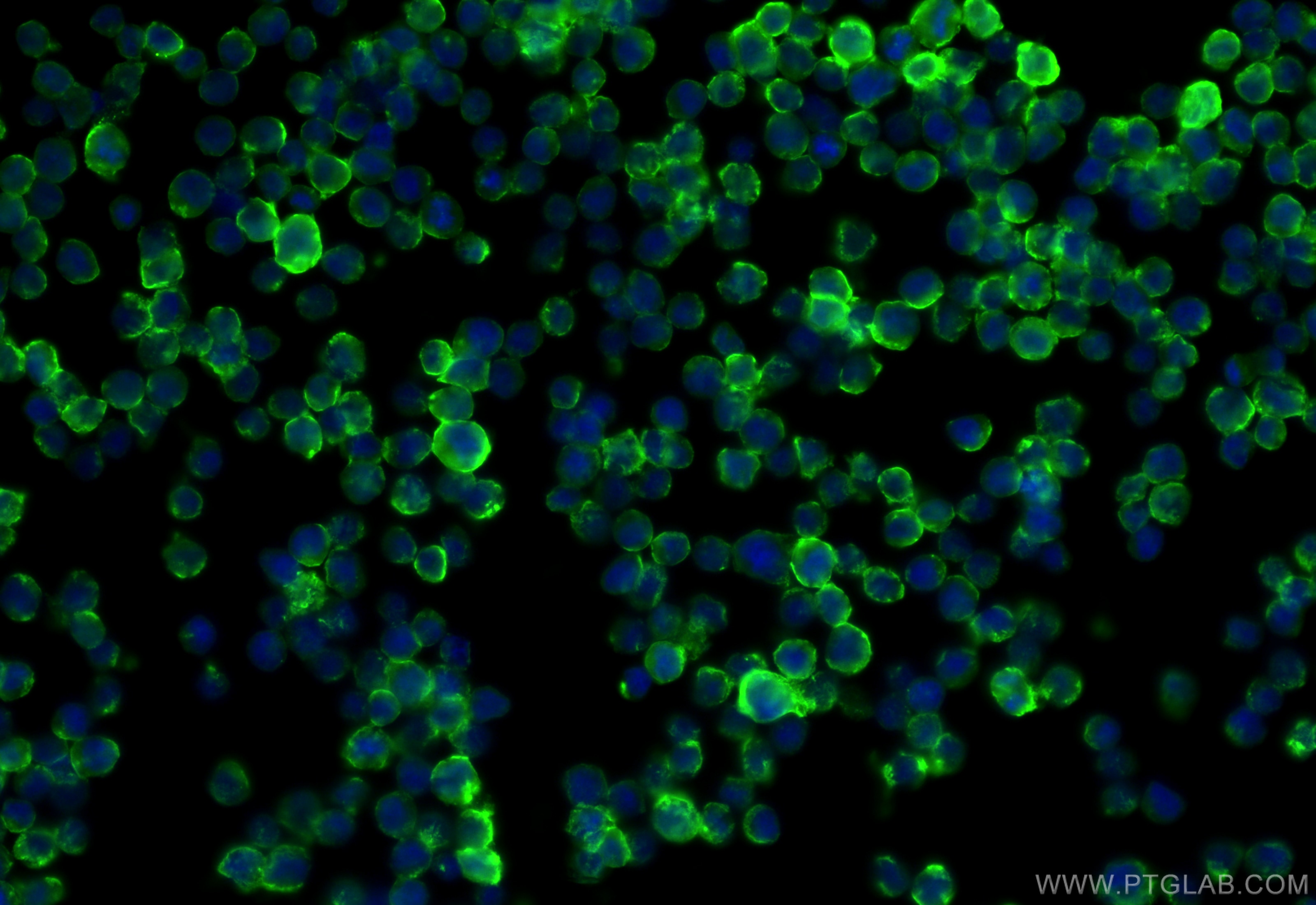 Immunofluorescence (IF) / fluorescent staining of Raji cells using HLA-DRB3 Polyclonal antibody (16789-1-AP)