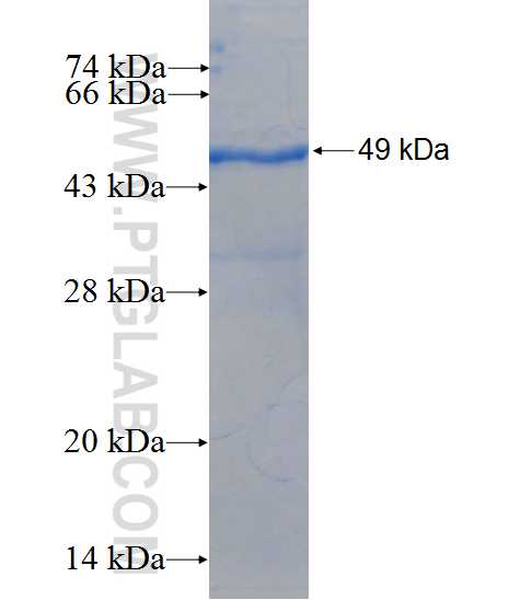 HLA-DRB3 fusion protein Ag10223 SDS-PAGE