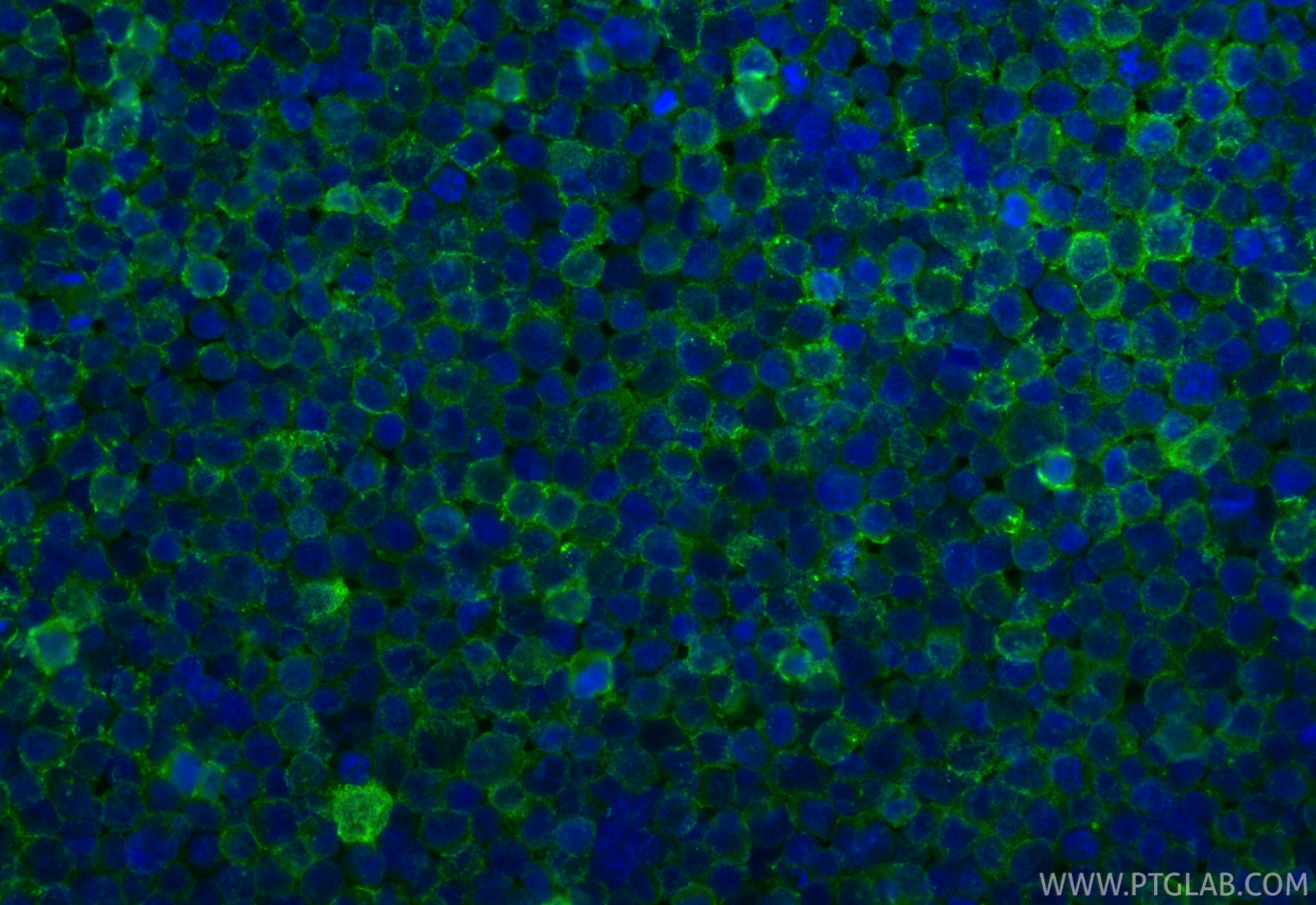 Immunofluorescent analysis of (4% PFA) fixed Raji cells using HLA-DRB4 antibody (15733-1-AP) at dilution of 1:400 and CoraLite®488-Conjugated Goat Anti-Rabbit IgG(H+L) (SA00013-2). Immunofluorescence (IF) / fluorescent staining of Raji cells using HLA-DRB4 Polyclonal antibody (15733-1-AP)