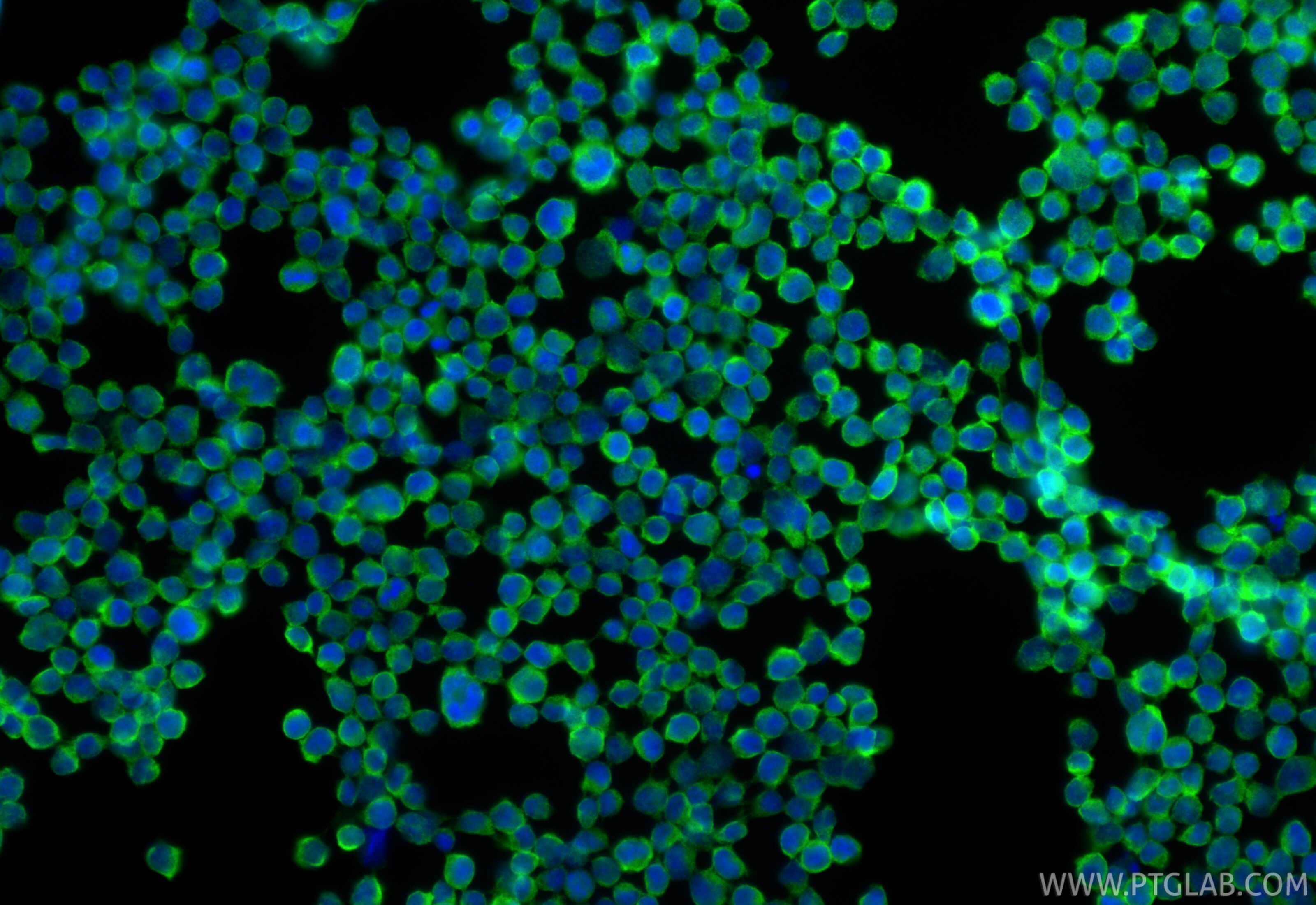 Immunofluorescent analysis of (4% PFA) fixed Jurkat cells using HLA-DRB4 antibody (15733-1-AP) at dilution of 1:200 and CoraLite®488-Conjugated Goat Anti-Rabbit IgG(H+L) (SA00013-2). Immunofluorescence (IF) / fluorescent staining of Jurkat cells using HLA-DRB4 Polyclonal antibody (15733-1-AP)